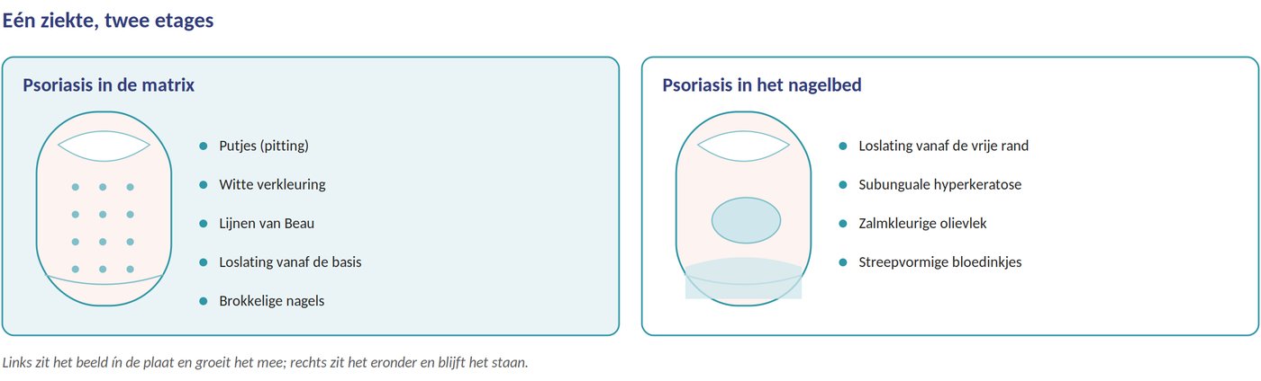 Nagelpsoriasis